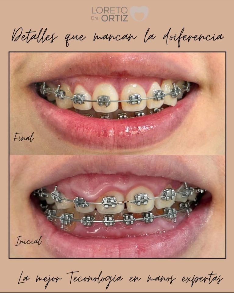 «Antes y después del tratamiento»